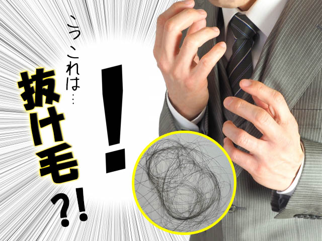 前兆 ハゲ はげの前兆を見逃すな！3つの前兆と3つのはげ対策